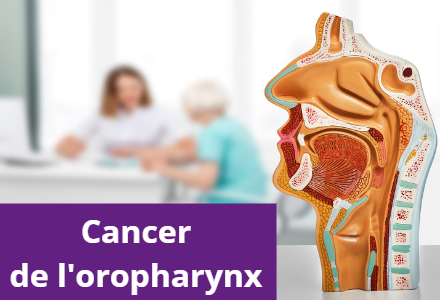 Cancer de l'oropharynx